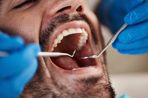 Full Mouth Reconstruction in Fairmount, IN